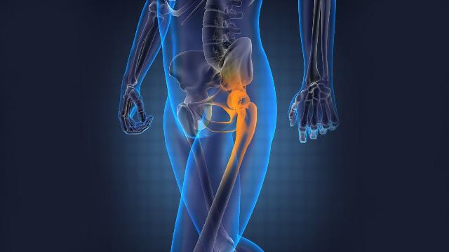 orthopedics